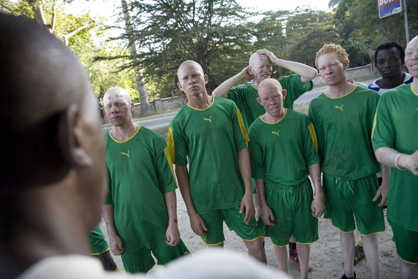 Albino football team